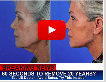 60 SECONDS TO REMOVE 20 YEARS